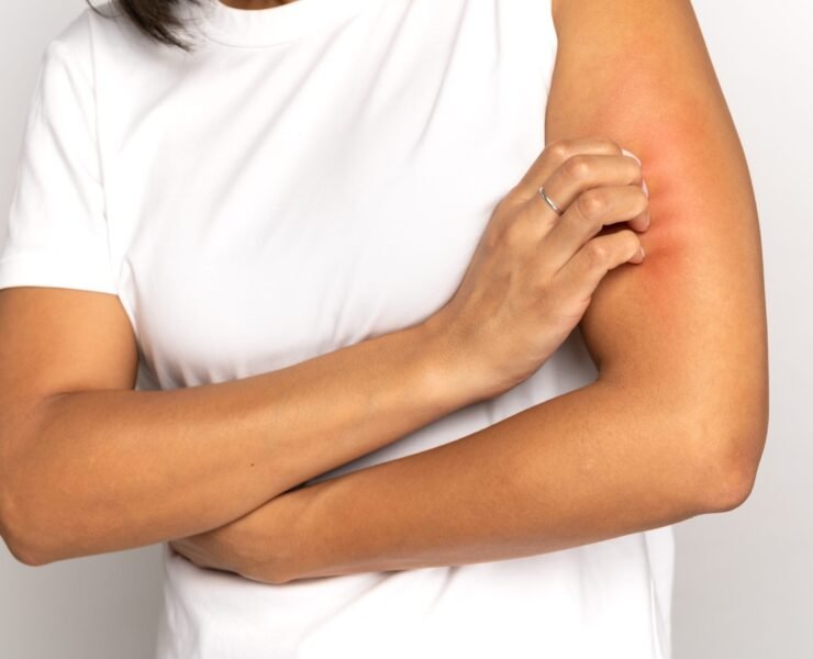 girl-scratching-itch-on-hand-suffer-from-dry-skin-2026-03-09-01-52-58-utc